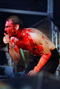 Haemorrhage 