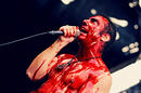 Haemorrhage 